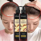 Šampon sa đumbirom 1+1 gratis