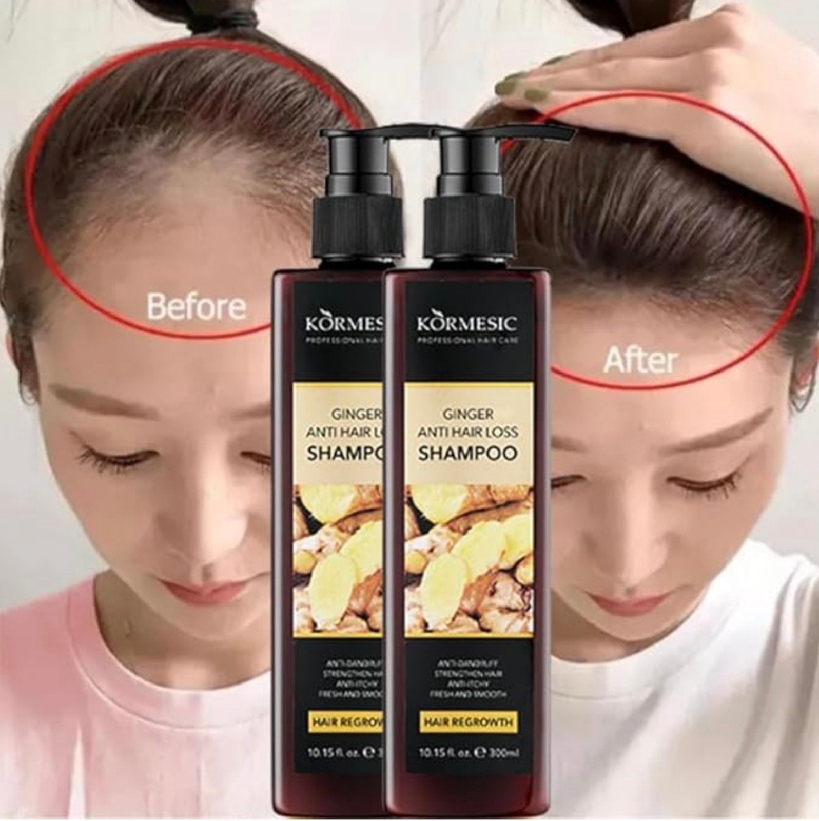 Šampon sa đumbirom 1+1 gratis
